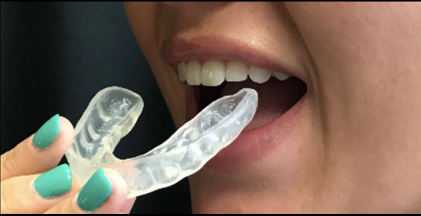 Close up of a mouth inserting a mouthguard