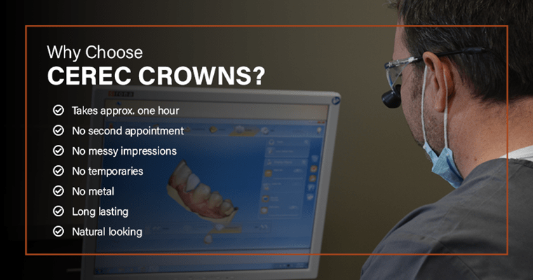 Why Choose CEREC Crowns? Takes approx. one hour, No second appointment, No messy impressions, No temporaries, No metal, Long lasting, Natural looking