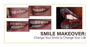 Are you ready to change your smile and change your life?